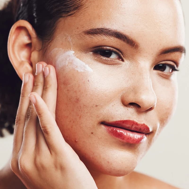 Acne Treatment | 3 Services